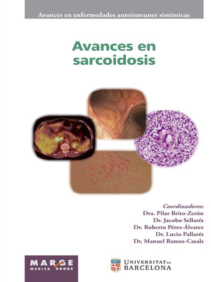 cover image of Avances en sarcoidosis